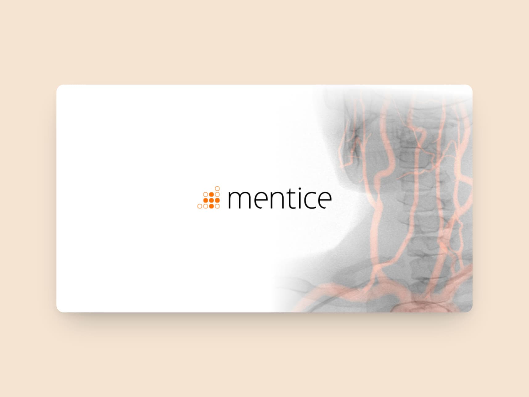 Investor Mentice